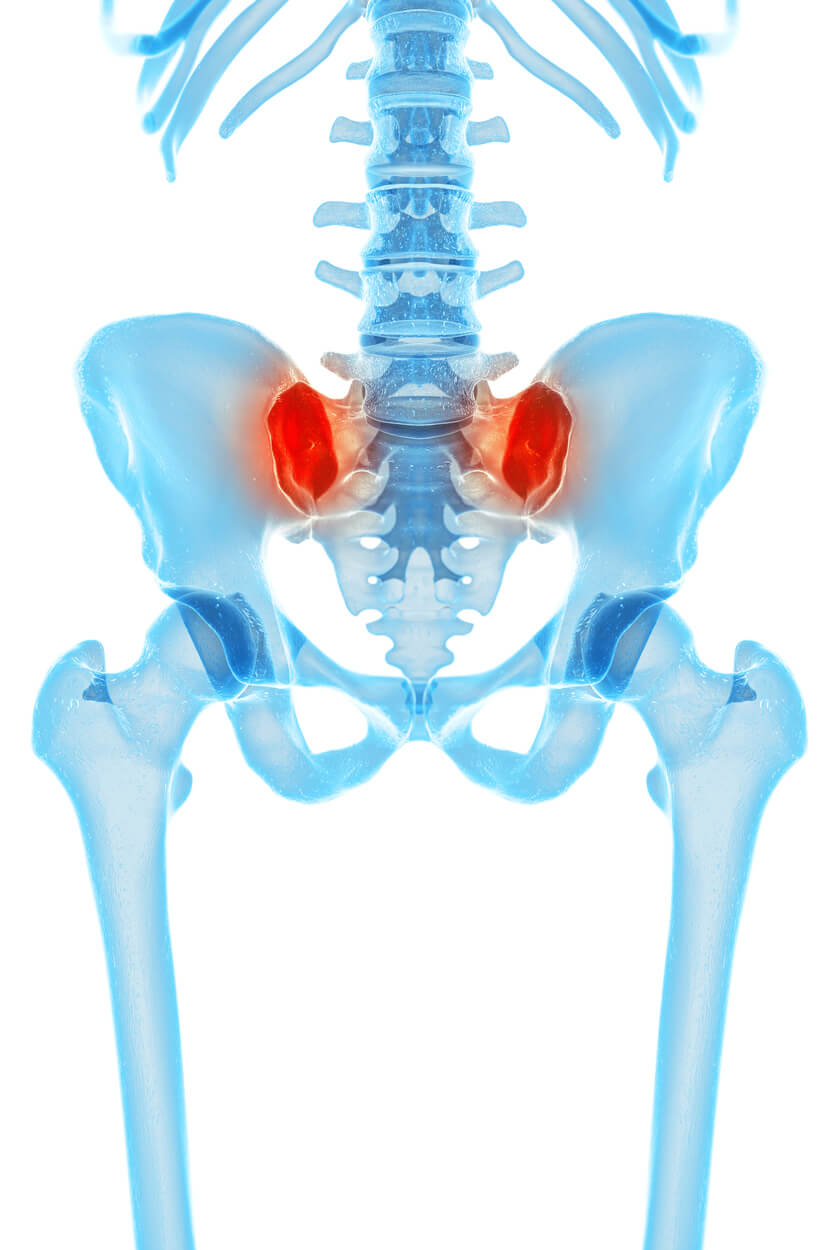 Sacroiliac Joint Dysfunction & Back or Hip Pain