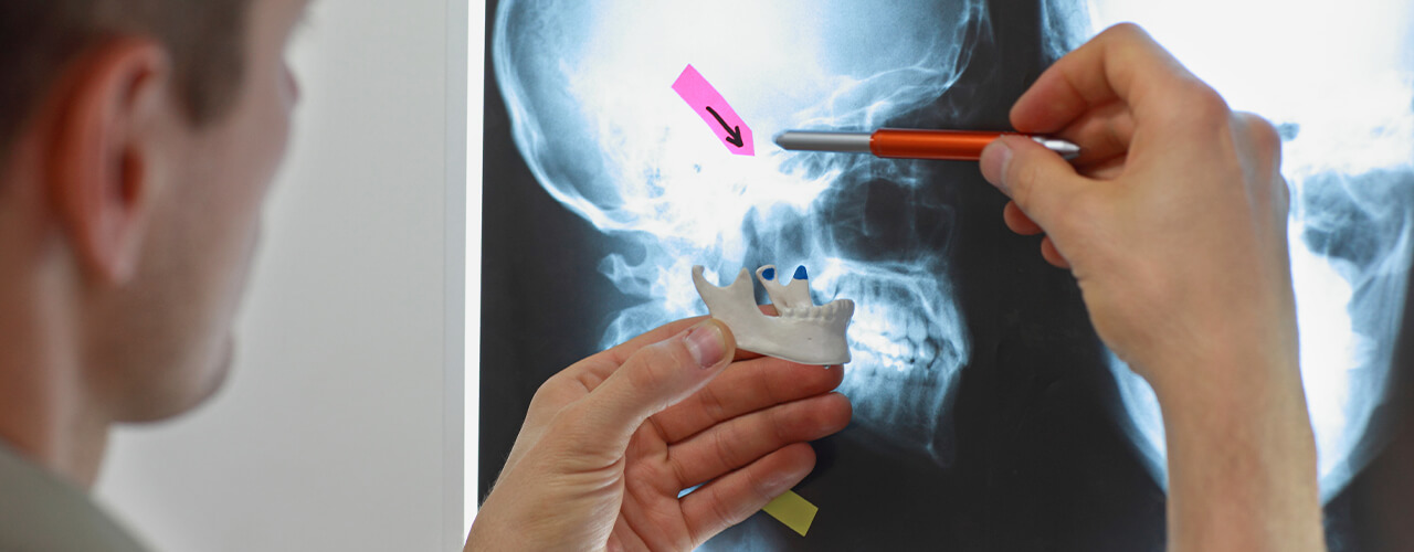 TMJ Dysfunction Highland, LaPorte, Crown Point, & Valparaiso, IN