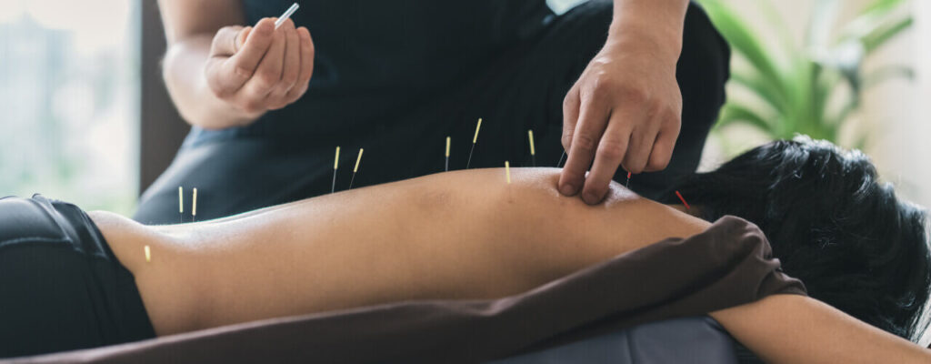 Can Needles Actually Relieve Pain?